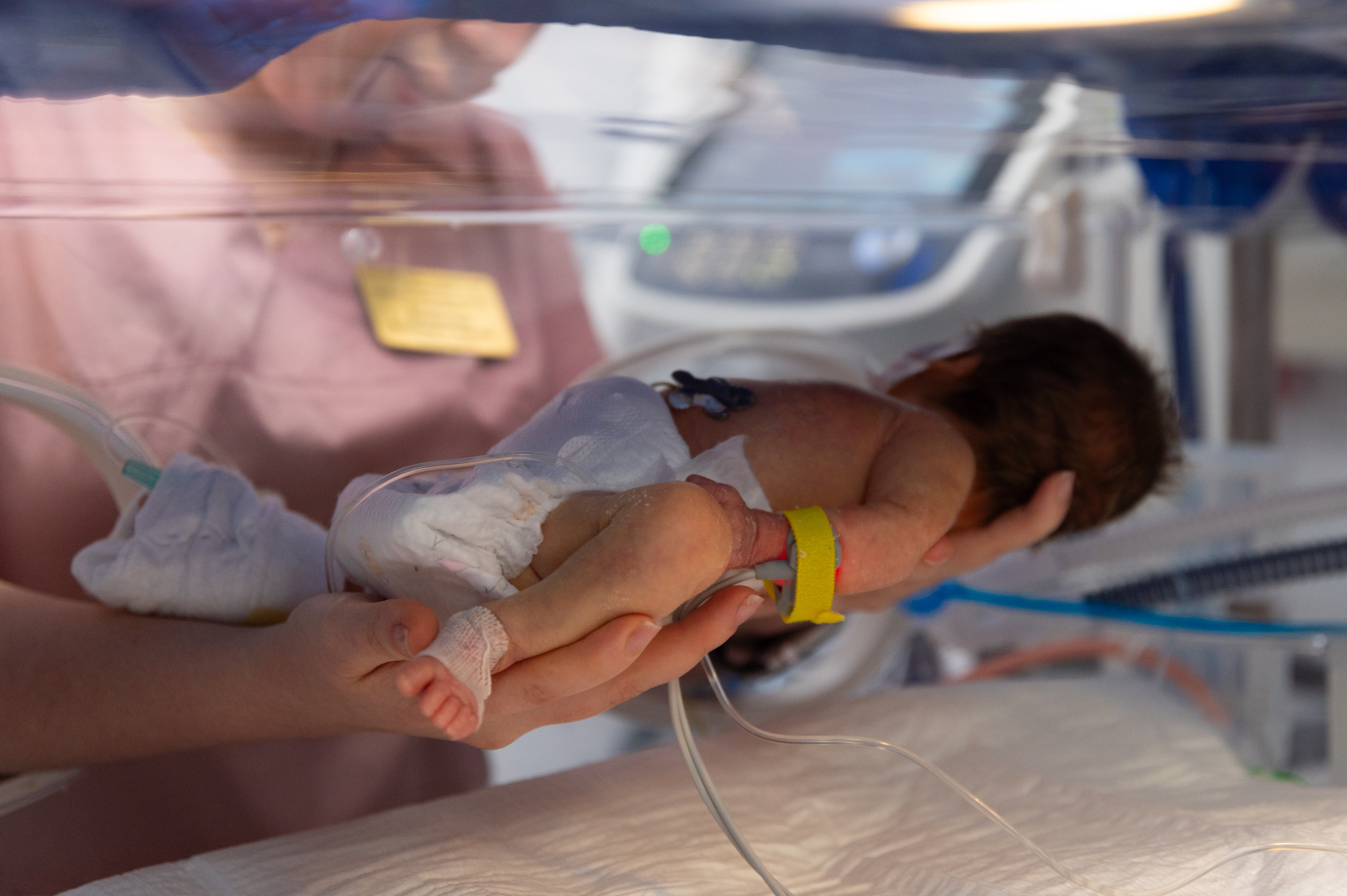 A newborn baby receives care in an incubator
