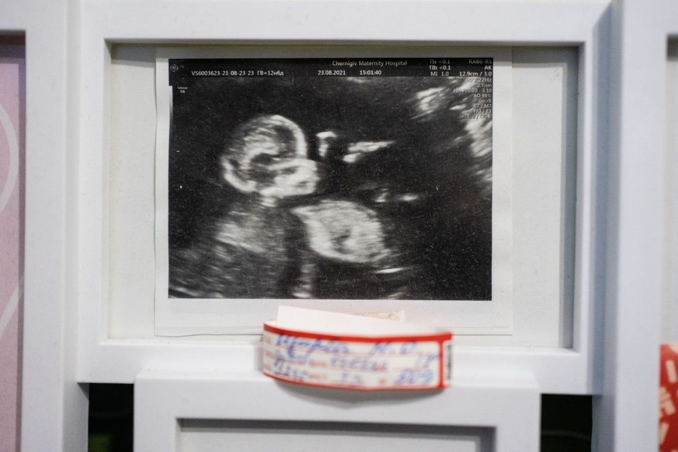 Ultrasound screen shows an unborn baby.