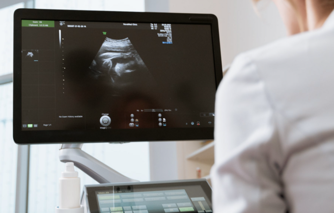 A doctor looking at an ultrasound screen