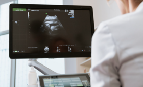 A doctor looking at an ultrasound screen
